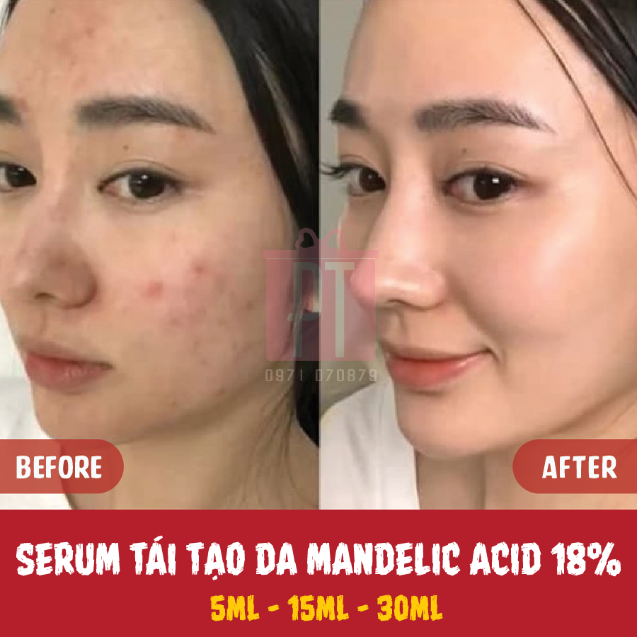 Serum tái tạo da Dr.Wu Intensive Renewal Serum With Mandelic Acid 18% 5ML