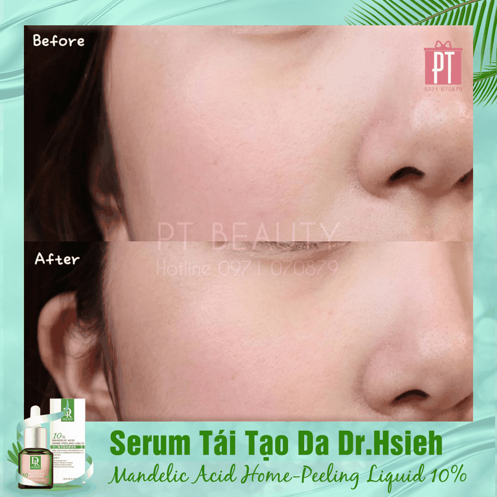 Serum Tái Tạo Da Dr.Hsieh Mandelic Acid Home-Peeling Liquid 10% 30ml