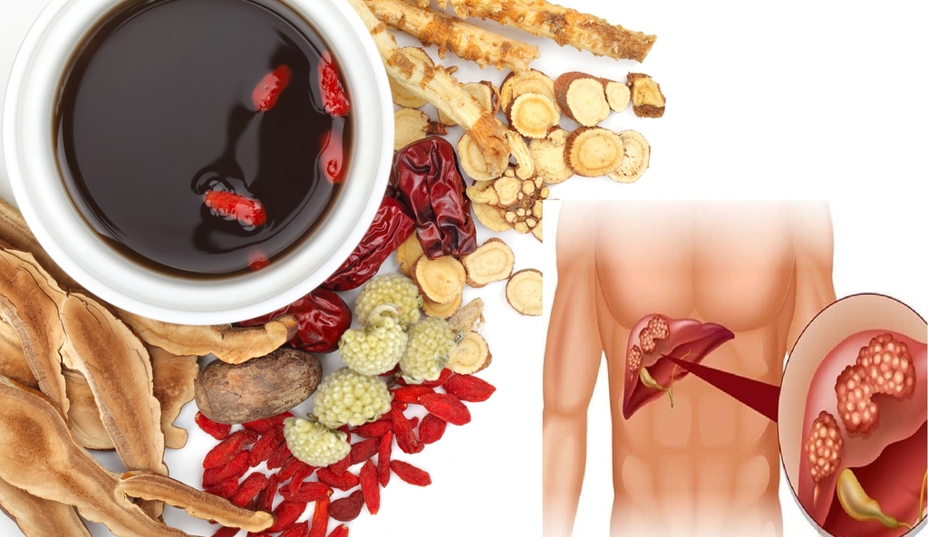 MỘT SỐ BÀI THUỐC CỔ PHƯƠNG CHỐNG UNG THƯ GAN (KHÁNG CAN NHAM) THƯỜNG DÙNG (Phần 1)