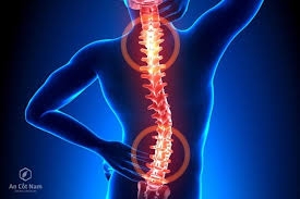 Thể dục giúp chữa thoát vị đĩa đệm