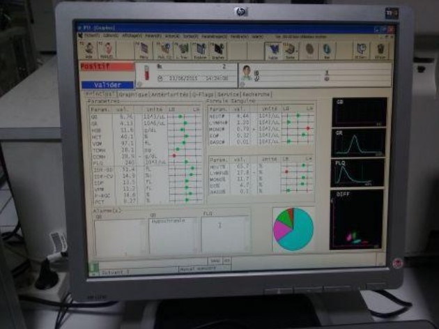 Cáp Kết Nối Máy Huyết Học Sysmex XS-1000i Với Máy Tính DATA Link RS232 Communication Crossover Null-Modem Serial RS232 DB9 Female to DB9 Female Colour Grey 3M