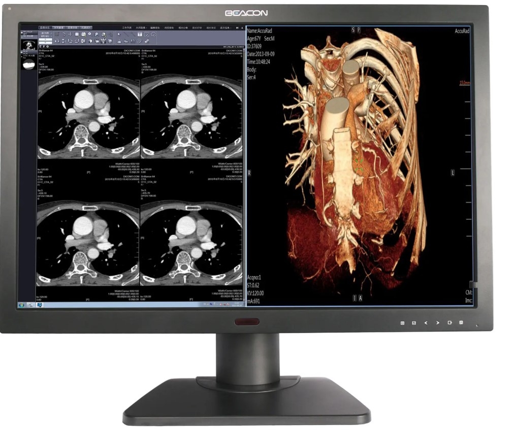 Cáp Medical Monitor With Cable VGA to VGA 10Ft Dài 3M up to 1920 x 1080 Pixels For Màn Hình Chẩn Đoán Hình Ảnh ADVANTECH PDC-W210 Diagnostic display C61W+