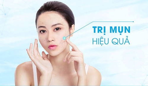 cach-tri-mun-hieu-qua