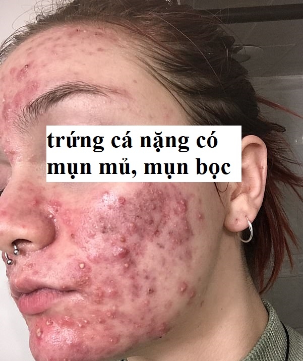 NHỮNG ĐIỀU BẠN CẦN BIẾT VỀ TRỨNG CÁ