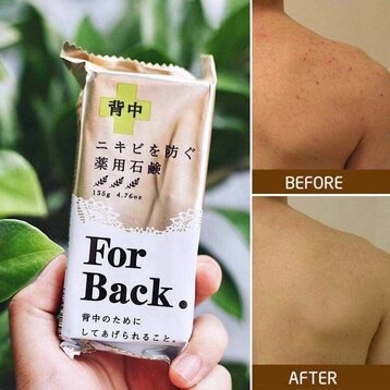 Xà phòng trị mụn lưng For Back