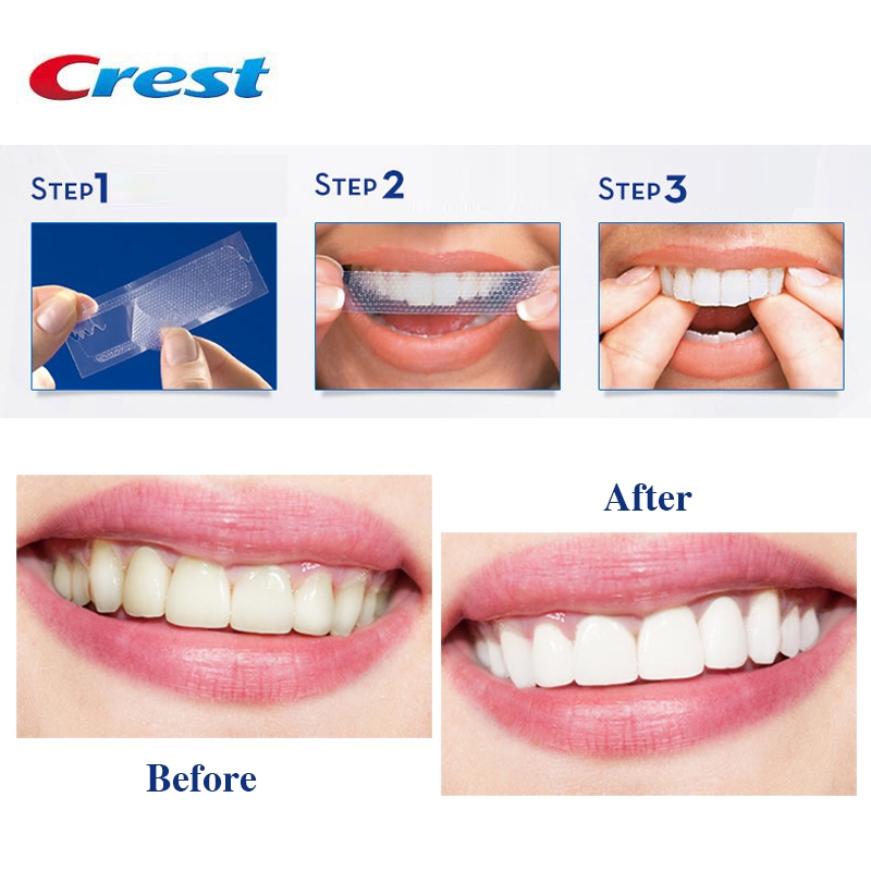 Combo 7 Miếng Dán Trắng Răng Crest 3D Whitestrips Professional Effects