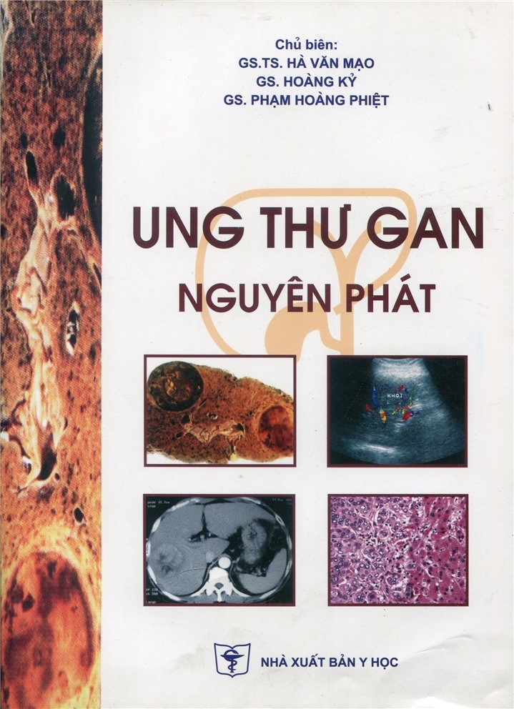 Sách - Ung thư gan nguyên phát