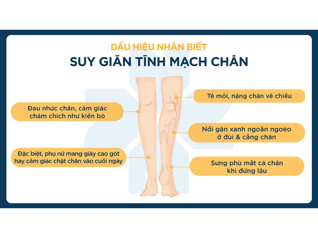 Thuốc điều trị giãn tĩnh mạch Green Naturals Rutin