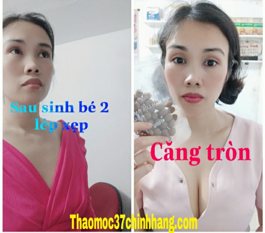 10 HỘP KẸO MẦM SÂM TỐ NỮ THẢO MỘC 37