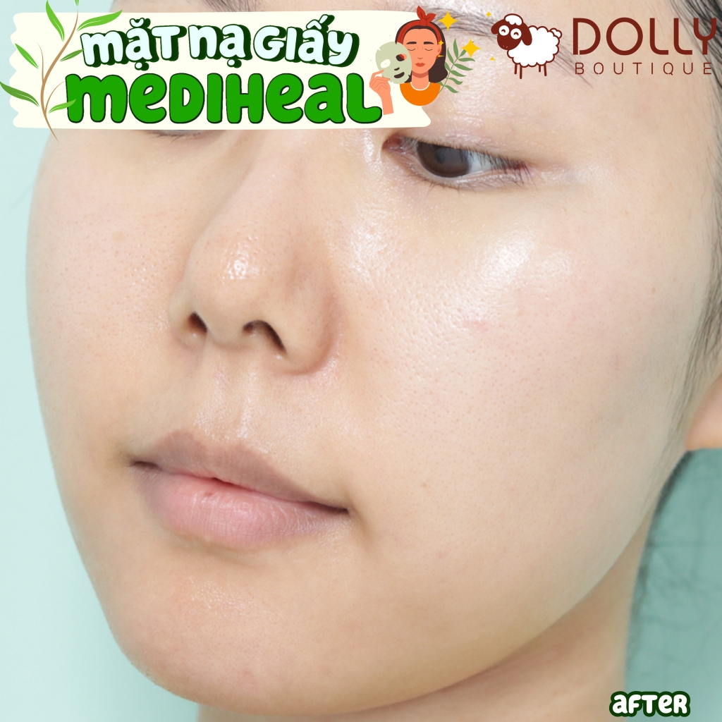 Mặt Nạ Miếng Mediheal Teatree Essential Mask 25ml