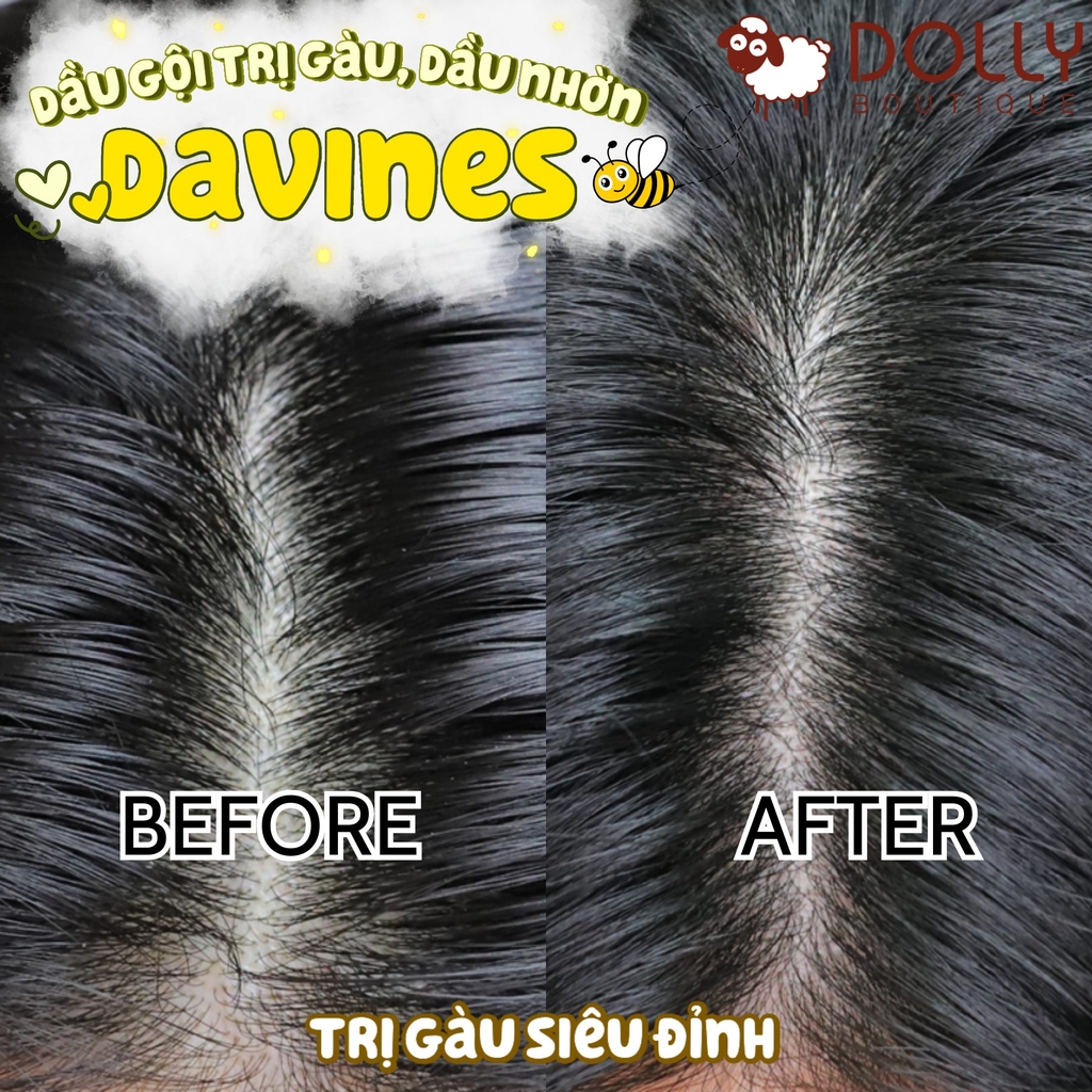 Dầu Gội Trị Gàu Davines Purifying Shampoo - 1000ml