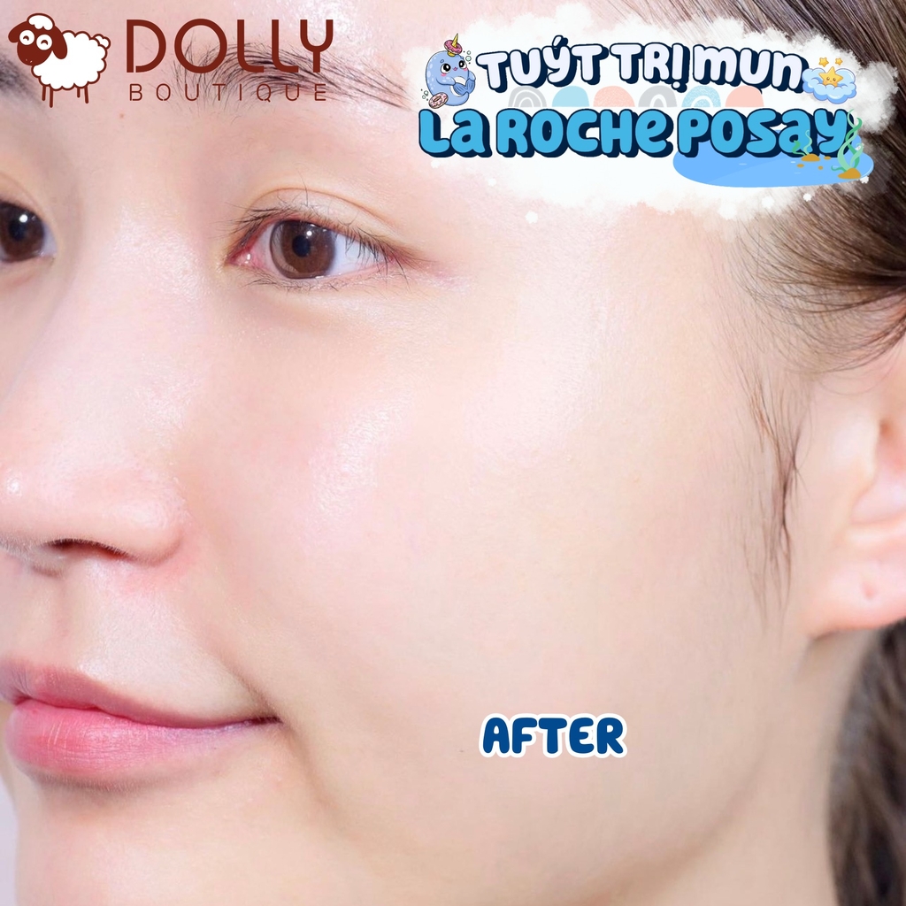 Kem trị mụn La Roche-Posay Effaclar Duo+ 1ml