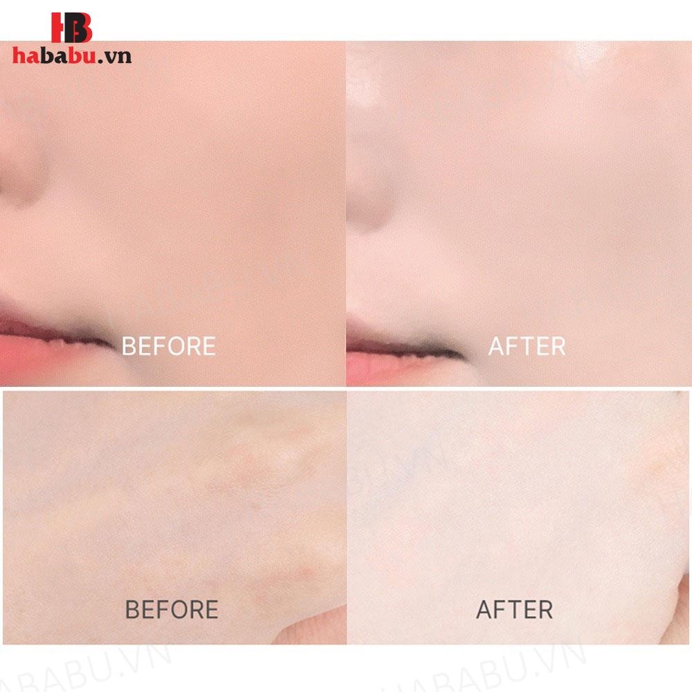 Tinh chất serum dưỡng da chống nắng Forencos 30ml chính hãng