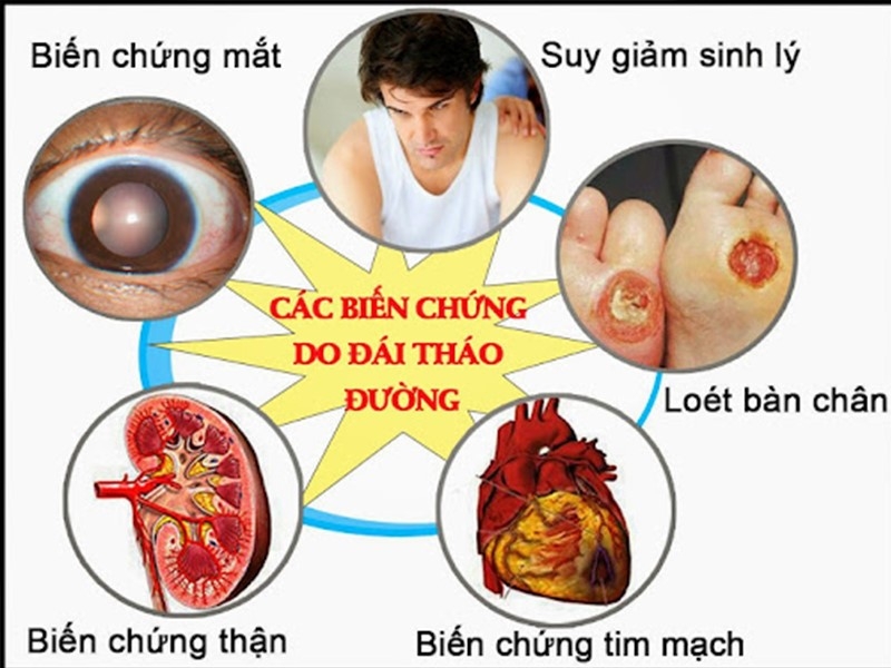 Bệnh tiểu đường và những biến chứng nguy hiểm.