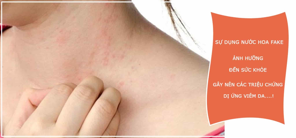 Dễ gây dị ứng, viêm da