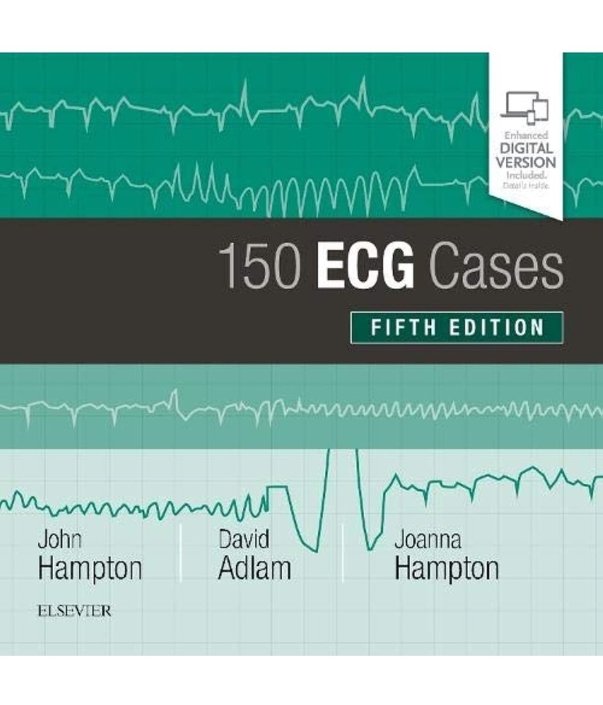 Sách ngoại văn 150 ECG Cases 5th