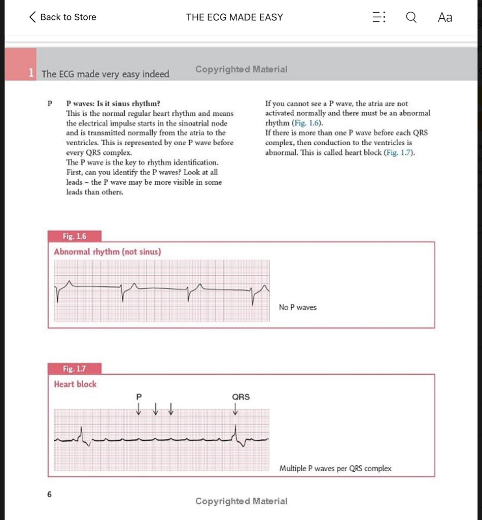 Sách ngoại văn The ECG Made Easy 9th