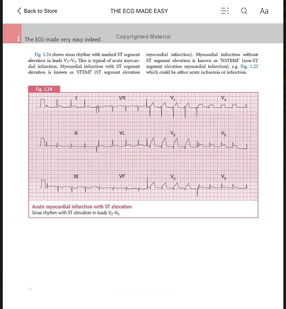 Sách ngoại văn The ECG Made Easy 9th