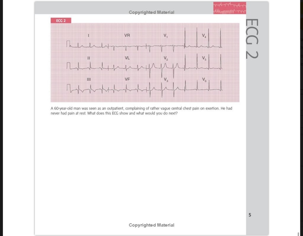 Sách ngoại văn 150 ECG Cases 5th