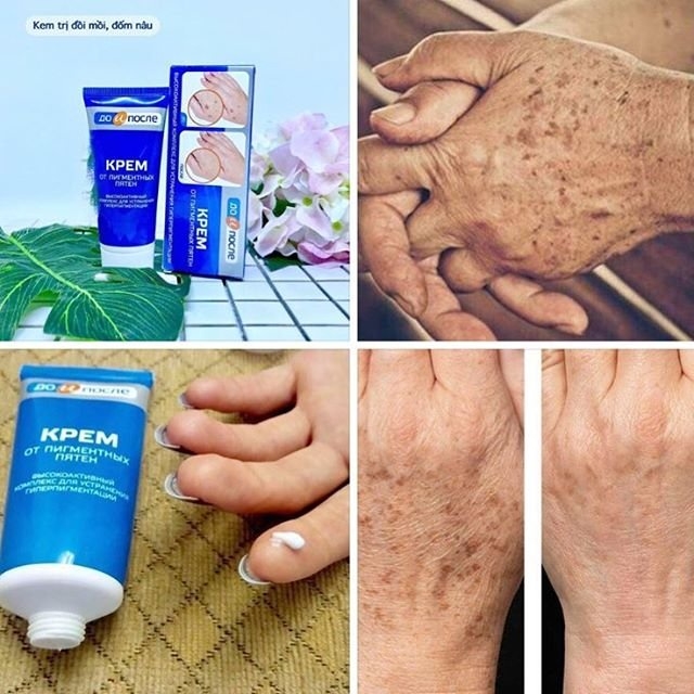 Kem Dưỡng Làm Mờ Phục Hồi Đốm Nâu Đồi Mồi Kpem Cream 50g