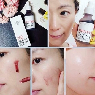 Serum Red Peel Tingle Tái Tạo Phục Hồi Da Sinh Học 35ml
