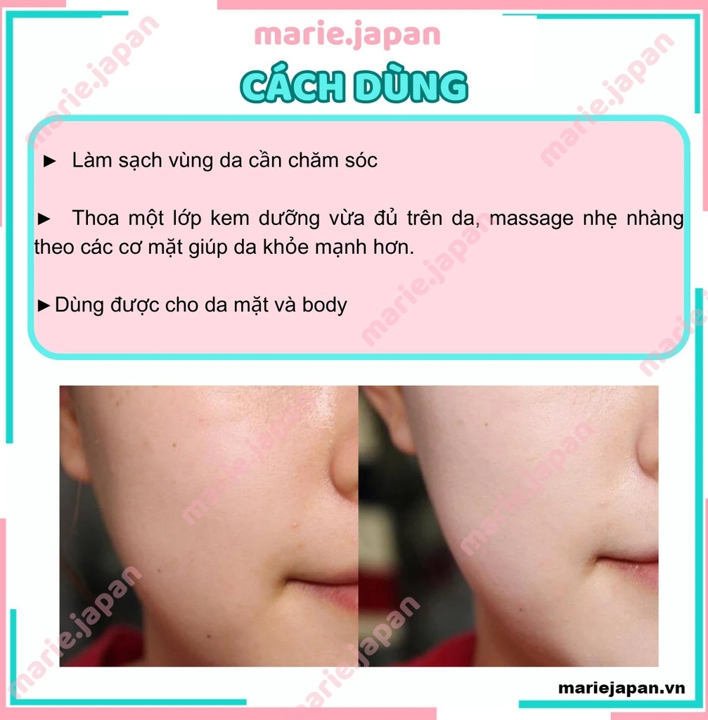 Kem Dưỡng Ẩm Redwin Vitamin E Cream Hũ 300g