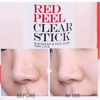 Serum Red Peel Tingle Tái Tạo Phục Hồi Da Sinh Học 35ml
