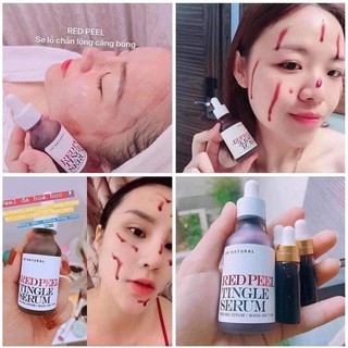 Serum Red Peel Tingle Tái Tạo Phục Hồi Da Sinh Học 35ml