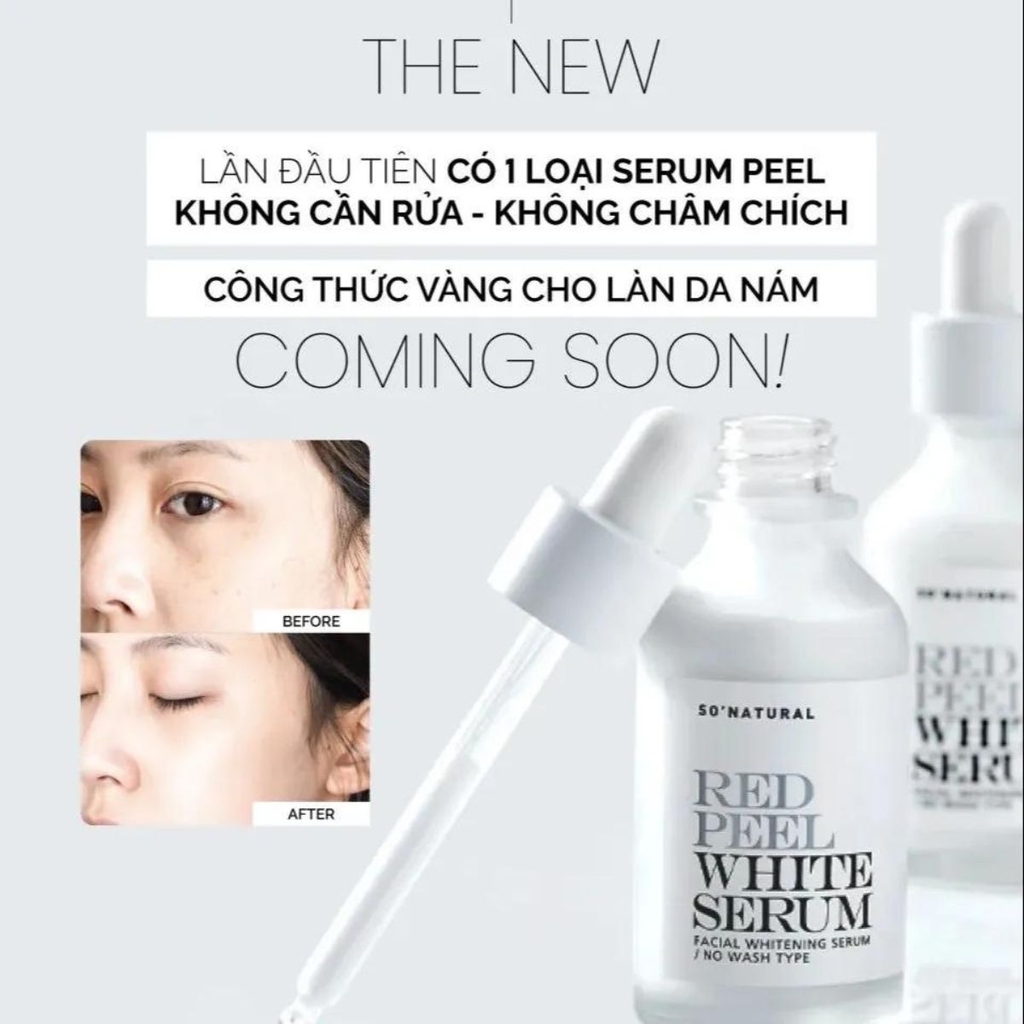 Serum Red Peel White Ức Chế Nám Dưỡng Trắng Da Từ Sâu Bên Trong Hàn Quốc 35ml