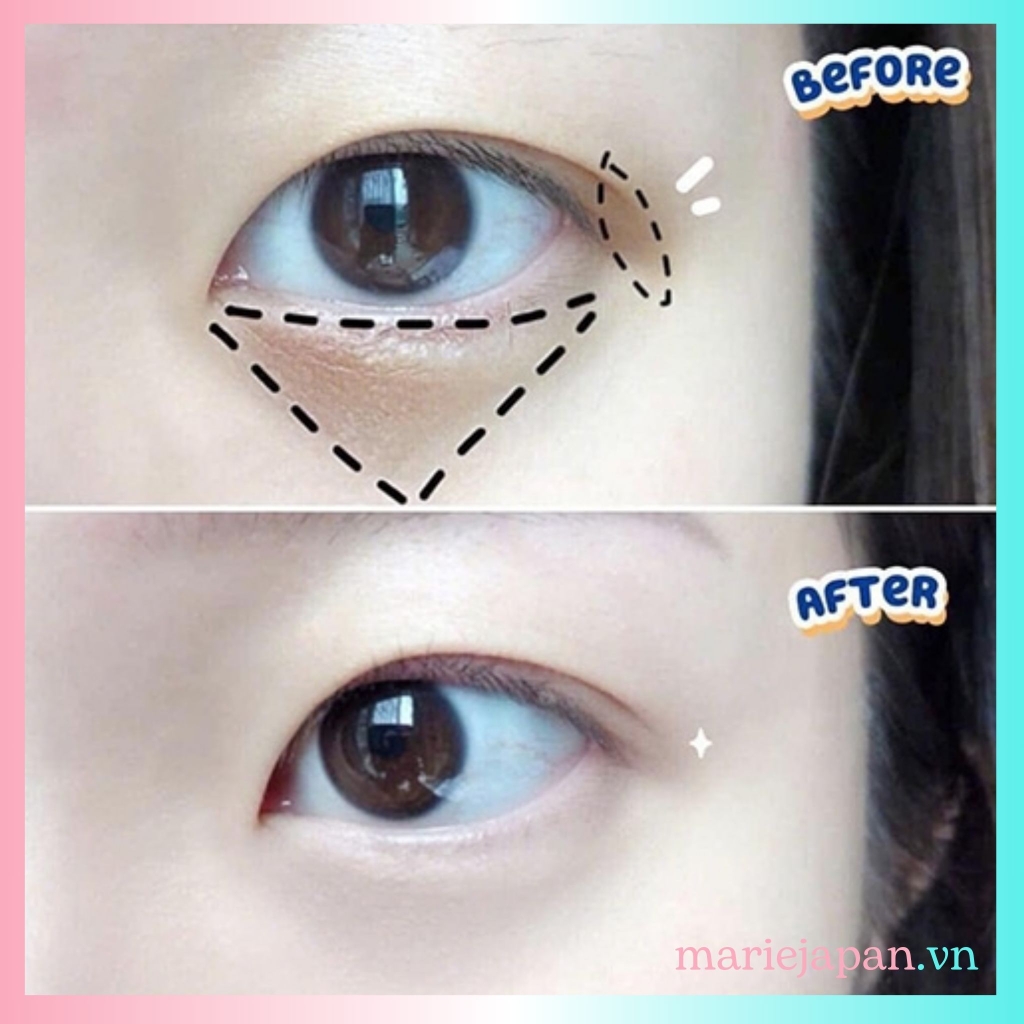 Kem Mắt Meishoku Dưỡng Sáng Giảm Quầng Thâm Mắt Whitening Eye Cream Nhật Bản 30g