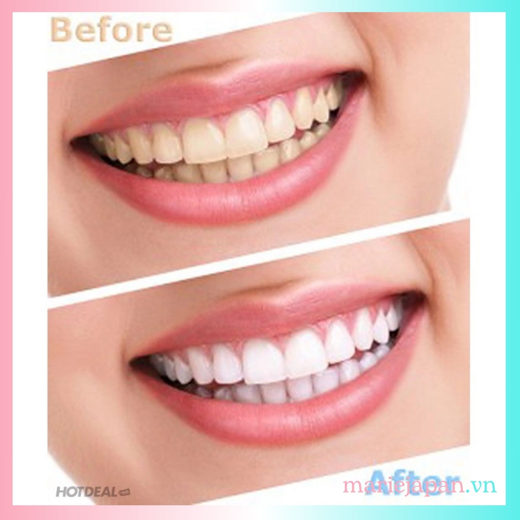 Nước Súc Miệng Propolinse Trắng Răng  Sạch Mảng Bám 600ml Nhật Bản