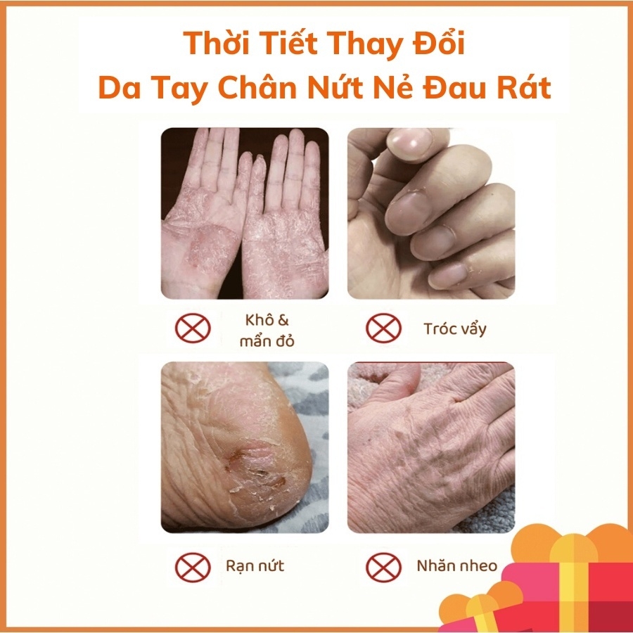 Kem Nẻ Gót Chân Heyxi Giảm Khô Ráp Mềm Mịn Da Chân Anti Crack Cream Hũ 20g