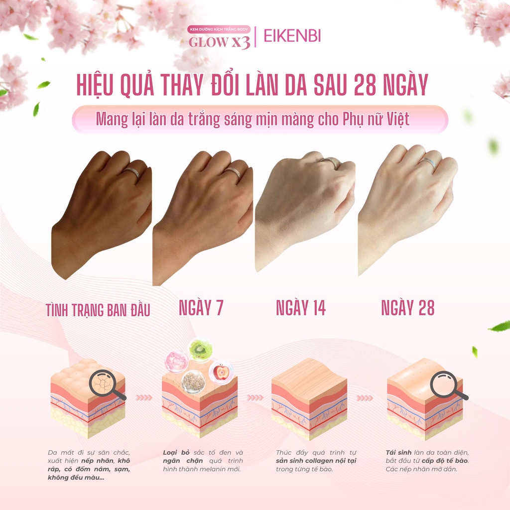Kem Kích Trắng Body Nâng Tone Glow X3 Eikenbi 200gr