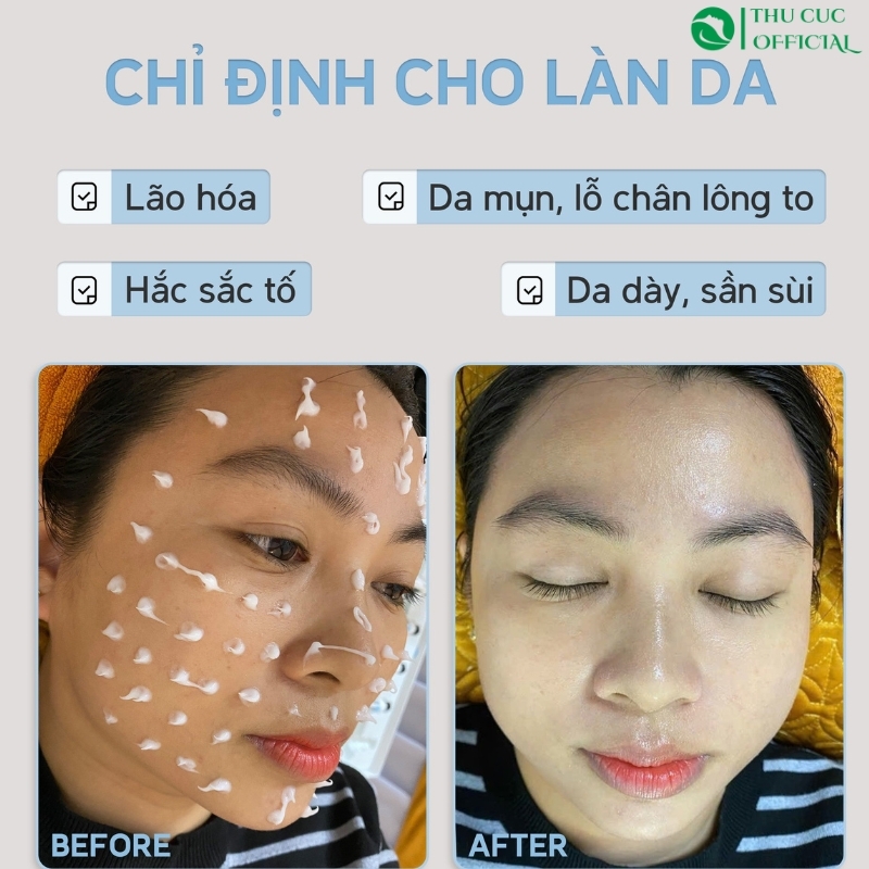 Bộ vi kim tảo biển dạng Kem Desembre Exfoliator 3in1 Peeling Cream