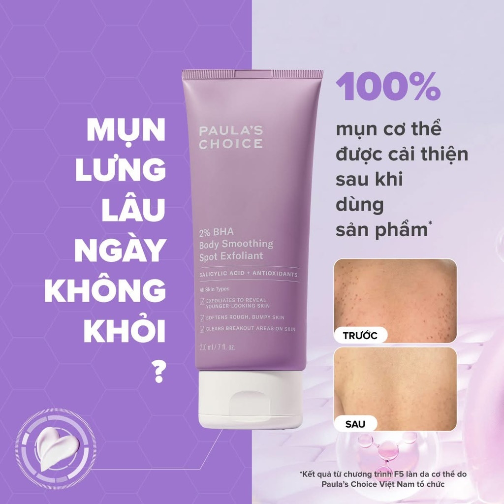 Kem Dưỡng Thể Paula's Choice Giảm Viêm Lỗ Chân Lông