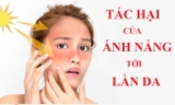 TÁC HẠI CỦA ÁNH NẮNG MẶT TRỜI TỚI LÀN DA