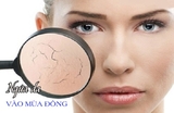 Cách phòng chữ ngứa da mùa đông