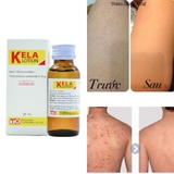 KELA LOTION TRỊ VIÊM NANG LÔNG