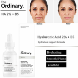 Tinh chất cấp nước, phục hồi da The Ordinary Hyaluronic Acid 2% + B5 30ml