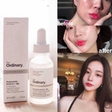 Tinh chất cấp nước, phục hồi da The Ordinary Hyaluronic Acid 2% + B5 30ml