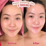 Kem Dưỡng Da Mờ Thâm Nám Ban Đêm L'Oreal Glycolic Bright Glowing Cream Night