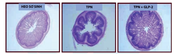 Hình ảnh cho thấy GLP-2 nhanh chóng phục hồi lại niêm mạc ruột non