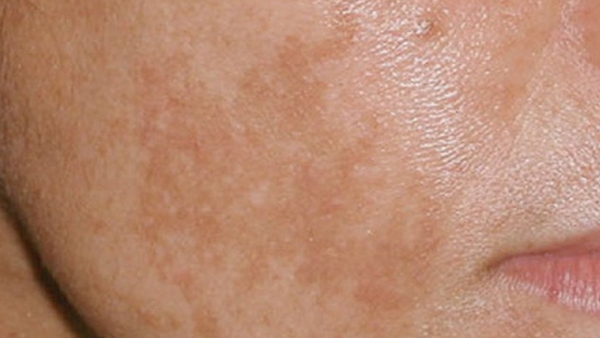 nam-da-o-nam-gioi-natalie