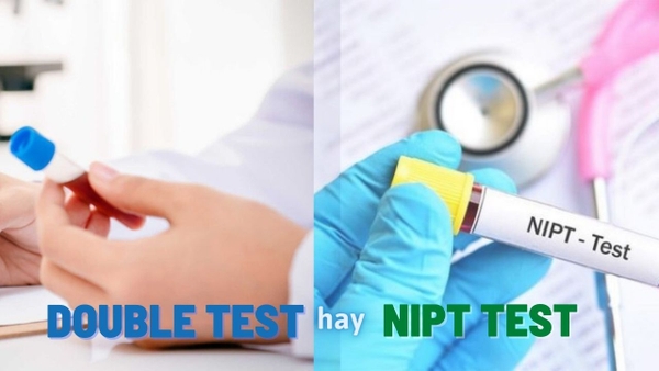Tư vấn: Nên làm xét nghiệm Double Test hay Nipt Test?