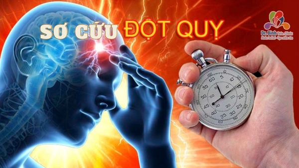 Hướng dẫn sơ cứu đột quỵ tại chỗ, cứu sống người bệnh 100%