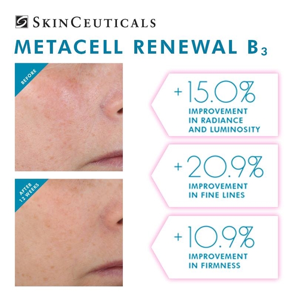 Serum chống lão hóa trẻ hóa da SkinCeuticals Metacell Renewal B3