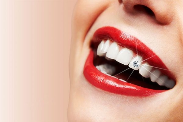 Răng đính kim cương – Tôn lên nét duyên ngầm của người phụ nữ
