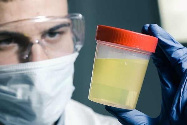 “Mũi điện tử” đánh hơi nước tiểu để tìm dấu vết ung thư tuyến tiền liệt