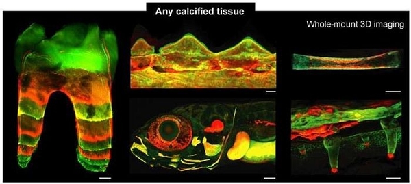 Phương pháp BEE-ST giúp theo dõi động lực phát triển của xương và răng theo thời gian