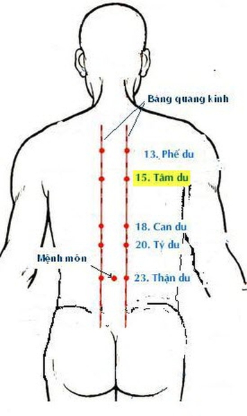 bi-viem-hong-thi-bam-huyet-nao